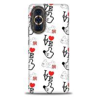 Huawei Nova 10 Pro Kılıf HD Baskılı Kılıf - Love Mickey + Tam Ekran Koruyucu