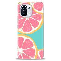 Xiaomi Mi 11 Kılıf HD Baskılı Kılıf - Pembe Limon + Tam Ekran Koruyucu