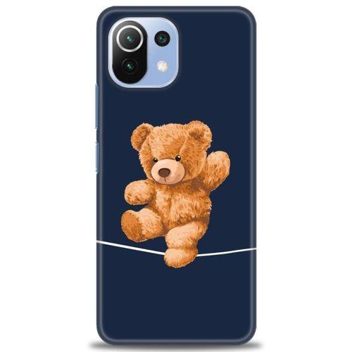 Xiaomi Mi 11 Lite Kılıf HD Baskılı Kılıf - İpteki Teddy + Tam Ekran Koruyucu