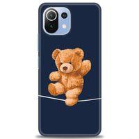 Xiaomi Mi 11 Lite Kılıf HD Baskılı Kılıf - İpteki Teddy + Tam Ekran Koruyucu