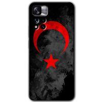 MRCİLETİSİM Xiaomi Redmi Note 11 Pro Plus 5G Kılıf HD Desen Baskılı Arka Kapak+Temperli Cam - Black Ayyıldız