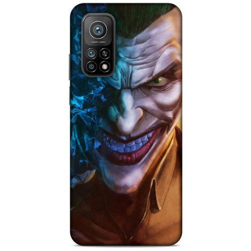 Xiaomi Mi 10T Pro 5G Uyumlu Kılıf Joker (27) Tasarımlı Kılıf Bebek mavisi
