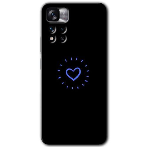 Potkal Hediye Fabrikası Xiaomi Redmi Note 11 Pro Plus 5G Kılıf HD Desen Baskılı Arka Kapak - Flash Logo