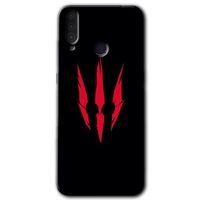 MRCİLETİSİM General Mobile GM 10 Kılıf HD Desen Baskılı Arka Kapak + Temperli Cam - Ayı Pençesi