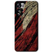 Xiaomi Redmi Note 11 Pro Plus 5G Kılıf HD Desen Baskılı Arka Kapak - Kumaş Deseni 6