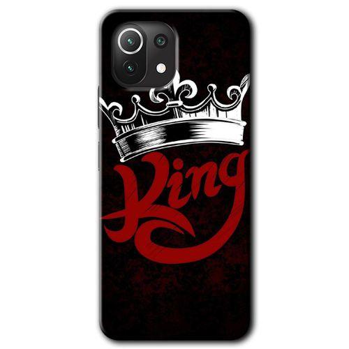 Xiaomi Mi 11 Lite Kılıf Baskılı Kapak - King + 5D Tam Kaplayan Cam