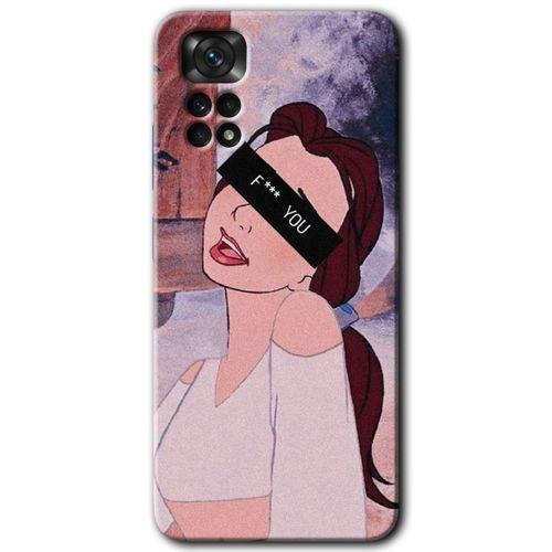 Xiaomi Redmi Note 11 5G Global Kılıf HD Desen Baskılı Arka Kapak+Temperli Cam - Bad Girl