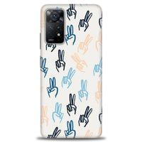 Xiaomi Redmi Note 11 Pro Kılıf HD Baskılı Kılıf - Tavşan Kulağı + Tam Ekran Koruyucu