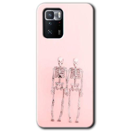 Poco x3 GT Kılıf Baskılı Kapak - Yaşayan Çift + 5D Tam Kaplayan Cam