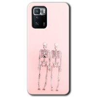 Poco x3 GT Kılıf Baskılı Kapak - Yaşayan Çift + 5D Tam Kaplayan Cam