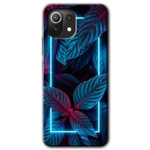 Xiaomi Mi 11 Lite HD Baskılı Kılıf + 9D Tam Ekran Koruyucu - Mekanik Yaprak 4