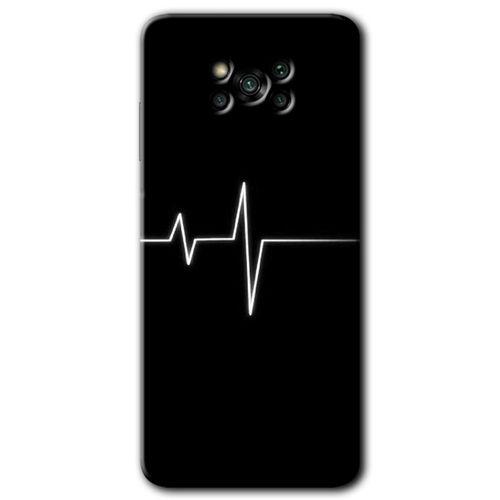 Poco x3 Pro Kılıf HD Desen Baskılı Arka Kapak - Heart Rytm