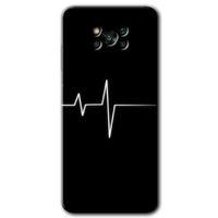Poco x3 Pro Kılıf HD Desen Baskılı Arka Kapak - Heart Rytm
