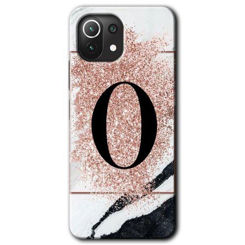 Xiaomi Mi 11 HD Baskılı Kılıf + 9D Tam Ekran Koruyucu - Pembe Mermer Desenli O Harfi