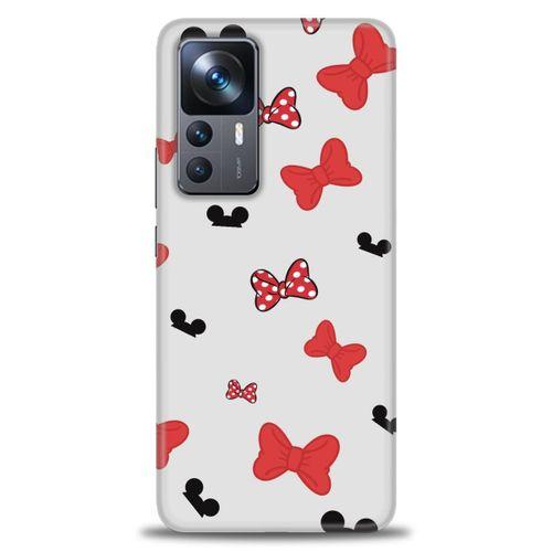 Xiaomi Mi 12T Kılıf HD Baskılı Kılıf - Fiyonklar + Tam Ekran Koruyucu