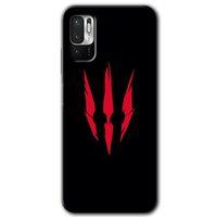 Redmi Note 10 5G Kılıf HD Desen Baskılı Arka Kapak - Ayı Pençesi