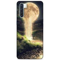 Lopard Oppo A91 Uyumlu Kılıf Manipülasyon ☻ (11) Tam Koruma Baskılı