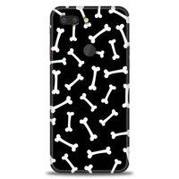 General Mobile GM 9 Pro Kılıf HD Baskılı Kılıf - Kemikler + Tam Ekran Koruyucu