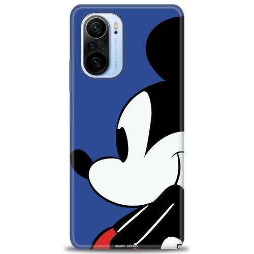 Xiaomi Mi 11i Kılıf HD Baskılı Kılıf - Micky Mouse + Tam Ekran Koruyucu