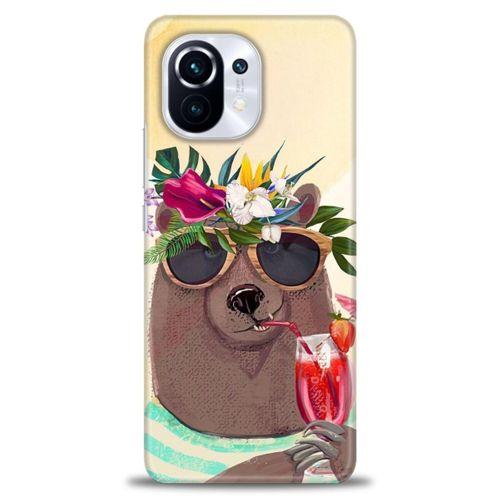 Xiaomi Mi 11 Kılıf HD Baskılı Kılıf - Keyifli Ayı + Tam Ekran Koruyucu