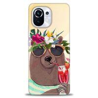 Xiaomi Mi 11 Kılıf HD Baskılı Kılıf - Keyifli Ayı + Tam Ekran Koruyucu