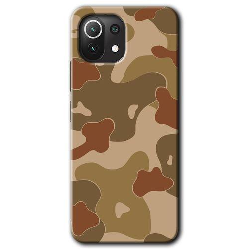 BeRa Aksesuar Xiaomi Mi 11 Lite Kılıf Baskılı Kapak - Kamuflaj 10 +Tam Kaplayan Mat Seramik
