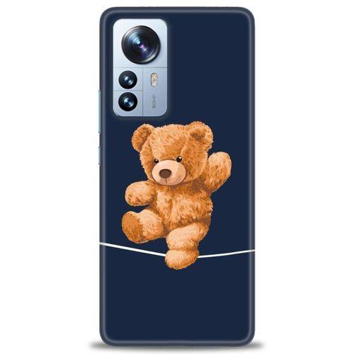 Xiaomi Mi 11 Ultra Kılıf HD Baskılı Kılıf - İpteki Teddy + Tam Ekran Koruyucu
