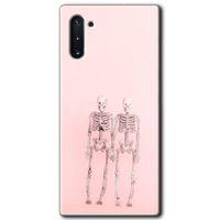 Samsung Galaxy Note 10 Kılıf HD Desen Baskılı Arka Kapak + Temperli Cam - Yaşayan Çift