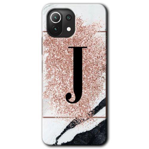 Potkal Hediye Fabrikası Xiaomi Mi 11 Lite Kılıf HD Desen Baskılı Arka Kapak - Pembe Mermer Desenli J Harfi