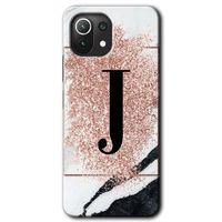 Potkal Hediye Fabrikası Xiaomi Mi 11 Lite Kılıf HD Desen Baskılı Arka Kapak - Pembe Mermer Desenli J Harfi