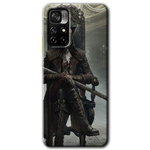 Poco M4 Pro 5G Kılıf HD Desen Baskılı Arka Kapak - Bloodborne Hunters + Kırılmaz Cam