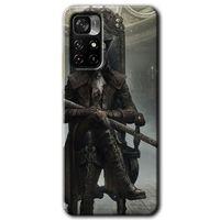 Poco M4 Pro 5G Kılıf HD Desen Baskılı Arka Kapak - Bloodborne Hunters + Kırılmaz Cam