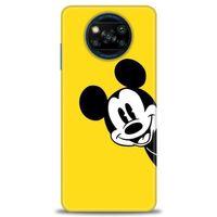 Xiaomi Poco X3 Pro Kılıf HD Baskılı Kılıf - Sarı Mickey Mouse + Tam Ekran Koruyucu