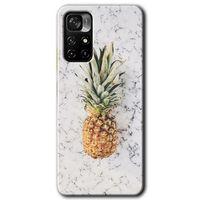Redmi Note 11T Kılıf HD Desen Baskılı Arka Kapak - Ananas + Kırılmaz Cam