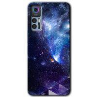 TCL 30 Plus Kılıf HD Desen Baskılı Arka Kapak - Galaksi