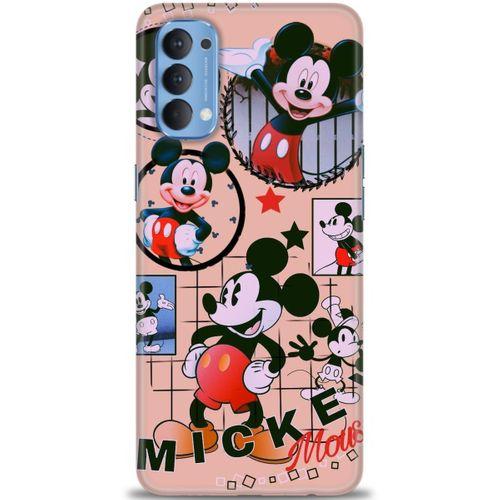 Oppo Reno 4 Kılıf HD Baskılı Kılıf - Mickey Mouse + Tam Ekran Koruyucu