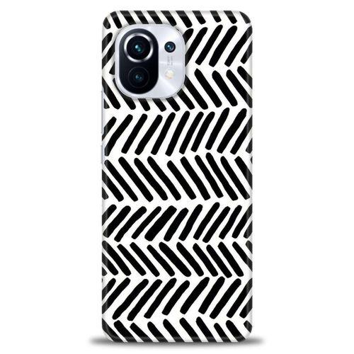Xiaomi Mi 11 Kılıf HD Baskılı Kılıf - Siyah Çubuklar + Tam Ekran Koruyucu