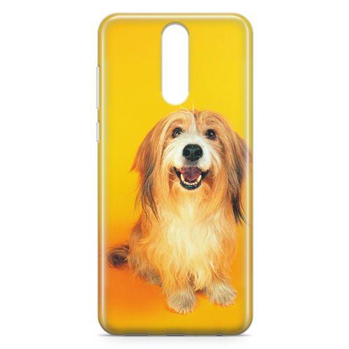 Huawei Mate 10 Lite Kılıf Collie Arka Kapak Koruma Desenli Full Koruyucu