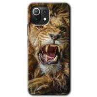 BeRa Aksesuar Xiaomi Mi 11 Lite Kılıf Baskılı Kapak - Lion King +Tam Kaplayan Mat Seramik