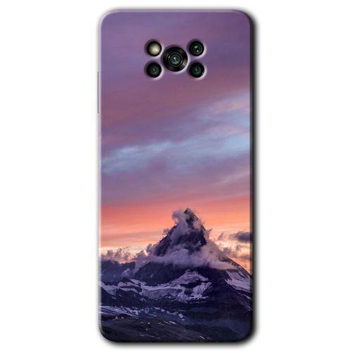 Poco x3 Pro Kılıf Baskılı Arka Kapak - Zirve +Tam Ekran Koruyucu