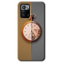 Poco x3 GT Kılıf HD Desen Baskılı Arka Kapak - Clocks Artwork