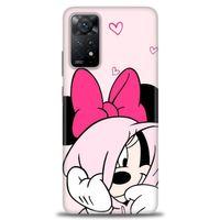 Xiaomi Redmi Note 11 Pro Kılıf HD Baskılı Kılıf - Pink + Tam Ekran Koruyucu
