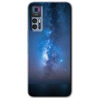 TCL 30 Plus Kılıf HD Desen Baskılı Arka Kapak - Samanyolu