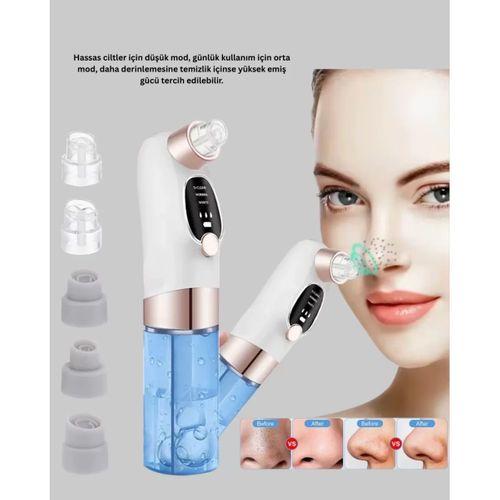 Ayarlanabilir Güç Seviyeli Vakumlu Siyah Nokta Temizleme Cihazı – Derin Gözenek Temizliği