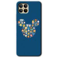 Omix X600 Kılıf HD Desen Baskılı Arka Kapak - Mickey