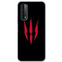 Huawei P Smart 2021 Kılıf HD Desen Baskılı Arka Kapak - Ayı Pençesi