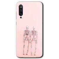 Xiaomi Mi 9 Kılıf HD Desen Baskılı Arka Kapak - Yaşayan Çift