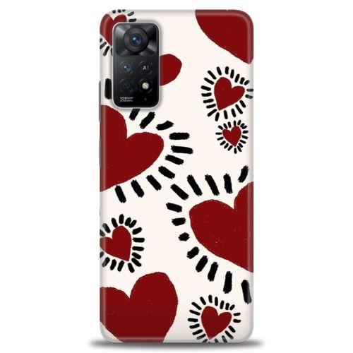 Xiaomi Redmi Note 11 Pro Kılıf HD Baskılı Kılıf - Çizgili Kalp + Tam Ekran Koruyucu
