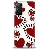 Xiaomi Redmi Note 11 Pro Kılıf HD Baskılı Kılıf - Çizgili Kalp + Tam Ekran Koruyucu