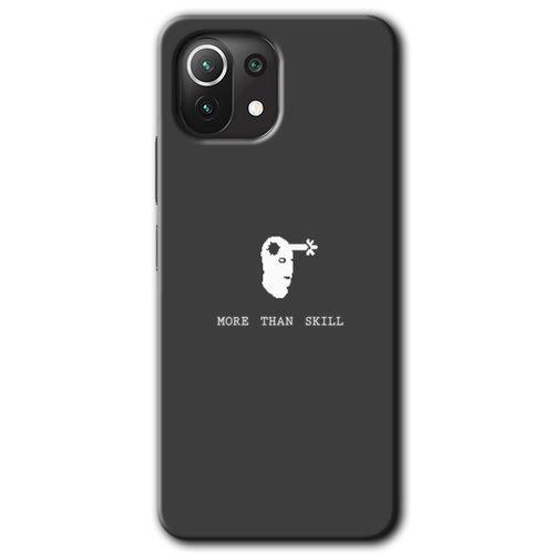 Xiaomi Mi 11 Lite Kılıf Kapak - Headshot +Hayalet Ekran Yandan Gözükmez